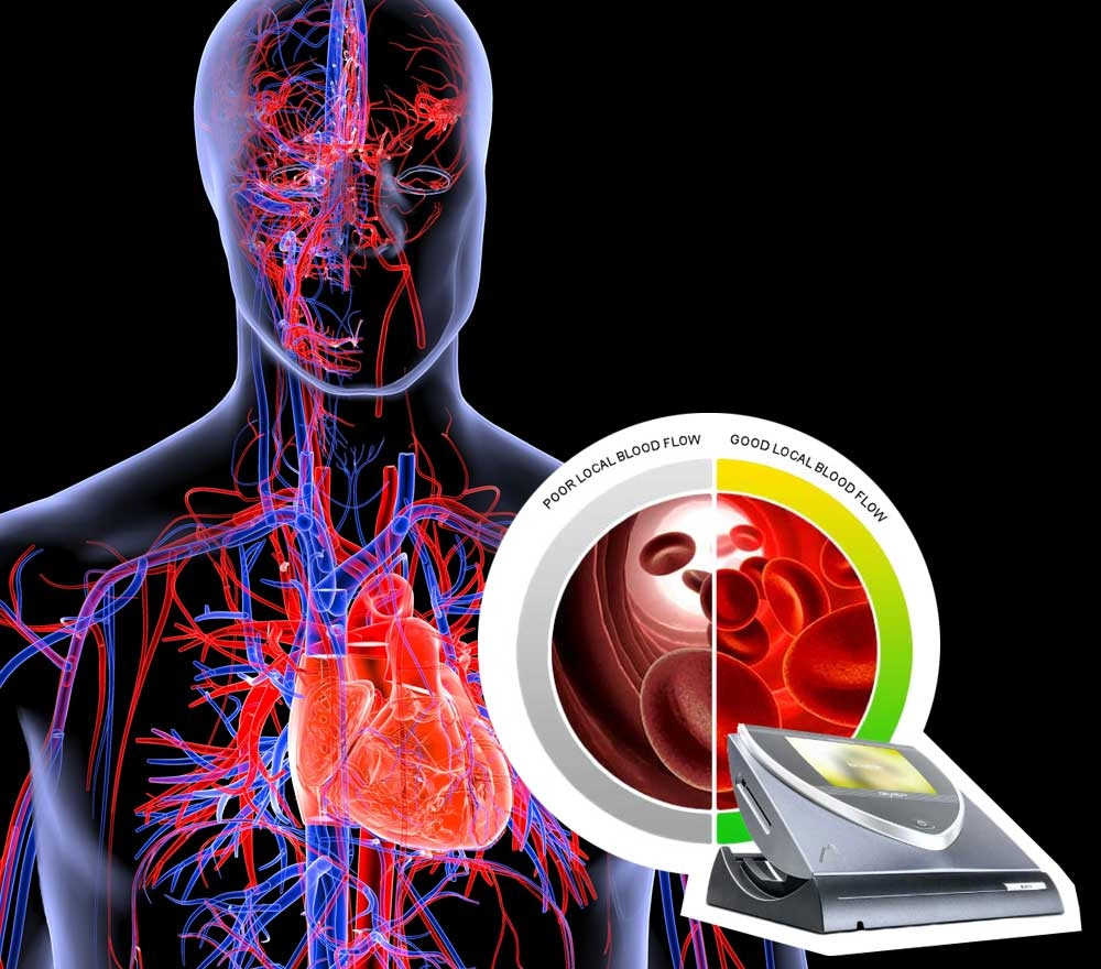 Vascular Therapy